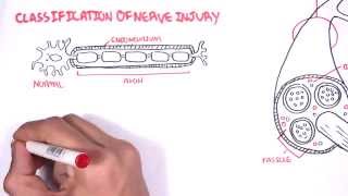 Neurology  Nerve Damage and Regeneration [upl. by Mosi]