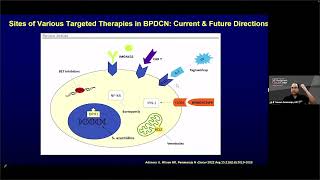 Advances in the Diagnosis and Treatment of BPDCN – Dr Naveen Pemmaraju May 2627 2023 [upl. by Nwahsaj506]