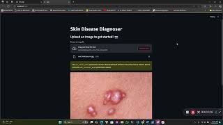 Skin Diseases Diagnoses AI [upl. by Tyoh]