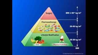 Current Management of Obesity [upl. by Savil]