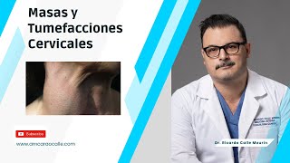 Masas y Tumefacciones en Cuello  LinfomasAdenopatias [upl. by Cave]