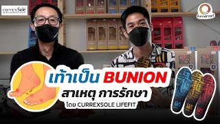 เท้า Bunion สาเหตุเกิดจากอะไร รักษาอย่างไร และ CurrexSole LifeFit ช่วยอย่างไร [upl. by Isoais762]