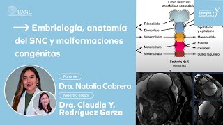 Embriología anatomía del SNC y malformaciones congénitas por la Dra Natalia Cabrera [upl. by Fen]