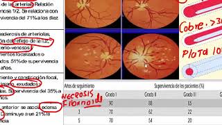 5 RETINOPATIA HTA [upl. by Klina]