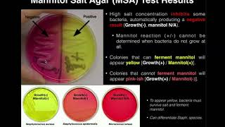 Mannitol Salt Agar MSA  Results amp Theory [upl. by Yurik]