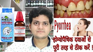 Pyorrhea  Homeopathic medicine for Periodontitis or Pyorrhea  Explain [upl. by Rennug703]