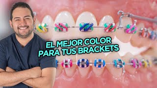 EL MEJOR y PEOR COLOR DE LIGAS PARA TÚ TRATAMIENTO DE BRACKETS  COMBINACIONES DE COLORES ORTODONCIA [upl. by Callas]