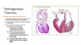 Left Ventricular Noncompaction A phenotype not a diagnosis [upl. by Efal]