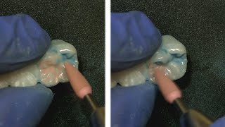 Achieve an incredible polish on Zirconia Dr Jason Smithson [upl. by Nnylsor]