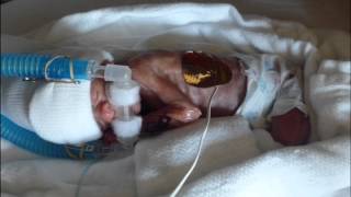 Our 27 week old preemie 115 lb miracle  Kaitlyns First Year [upl. by Bornie]