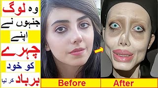 People Who Destroyed their Faces with Cosmetic Surgeries [upl. by Dom242]