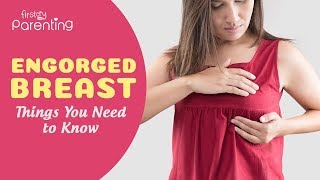 Breast Engorgement  Symptoms Causes amp Remedies [upl. by Nirda329]