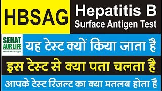 HBSAG Test Hepatitis B surface antigen test यह टेस्ट क्यों किया जाता है इस टेस्ट से क्या पता चलता है [upl. by Nahgam]