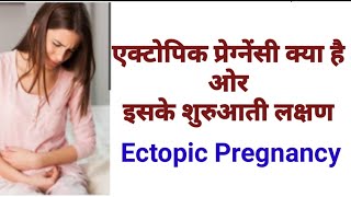 What is Ectopic Pregnancy Causes and Symptomsएक्टोपिक प्रेगनेंसी के लक्षणEctopicpregnancyBy Nida [upl. by Christyna]