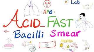 Acid Fast Bacilli Smear AFB smear for tuberculosis TB  Labs 🧪 [upl. by Mcquillin]