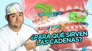 ¿PARA QUE SIRVEN LAS CADENAS ELÁSTICAS EN TUS BRACKETS ¿CUANDO SI Y CUANDO NO en tu ORTODONCIA [upl. by Assirk]