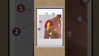The 12 most common pain locations in the shoulder [upl. by Cathe682]