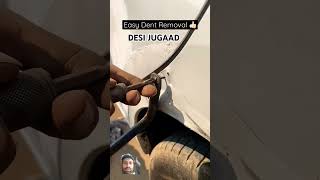 DESI JUGAAD DENT REMOVAL [upl. by Butterworth]