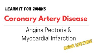 Atherosclerosis Angina Pectoris and Myocardial Infarction lecture discussion [upl. by Konstanze]