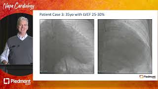 Appraisal of Successes and Shortfalls in CTO Revascularization [upl. by Neik]