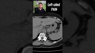 Is this PAINFUL Spot the disease  CT SCANS Ep 16 medicalimaging abdominalpain medicalquiz [upl. by Yhtomit]