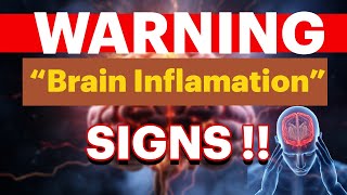 MUST WATCH   You May Have a Brain Inflammation  Encephalitis Signs and Symptoms [upl. by Dnaltroc]