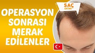 Saç Ekimi Operasyonu Sonrası Dikkat Edilmesi Gerekenler Nelerdir  Dr Hamid AYDIN [upl. by Gary]