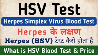 HSV Test in hindi  Herpes Simplex Virus Test  Causes amp Symptoms of Herpes Simplex Virus HSV Test [upl. by Cristian]