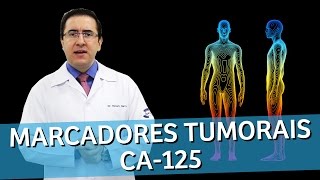 CA 125 Marcador Tumoral  O que significa este marcador tumoral CA125  IMEB [upl. by Mannos]