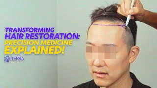 Transforming Hair Restoration Precision Medicine Explained Clearly  Hair Talks by Terra Medical [upl. by Doug224]