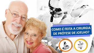 COMO É FEITA A CIRURGIA DE PRÓTESE DE JOELHO [upl. by Nediarb]