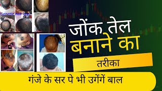 जोंक तेल बनाने का तरीका । जोंक तेल जो गंजे सर पे बाल उगा दे  Leech oil Benefits [upl. by Nyliram]