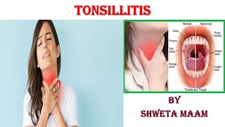 ⁣ Tonsillitis Causes Signs and Symptoms Diagnosis and Treatment Presented by Shweta Maam [upl. by Engen891]