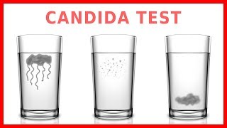 Do You Have Candida Take The quotSpit Testquot [upl. by Adnarb]