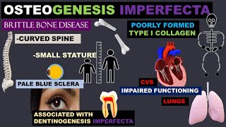 OSTEOGENESIS IMPERFECTA [upl. by Ennybor]