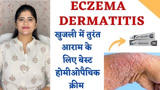 Best Homeopathic cream for Eczema and Dematitis ॥ खुजली में तुरंत आराम Gives instant Relief [upl. by Nahaj]