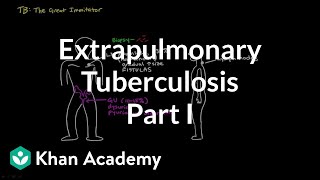 Extrapulmonary TB part 1  Infectious diseases  NCLEXRN  Khan Academy [upl. by Anitak]