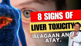 8 Signs of Liver Toxicity Alagaan ang Atay  Payo ni Doc Willie Ong [upl. by Haleigh372]