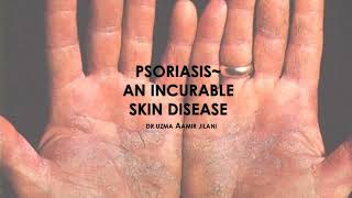 PSORIASIS A SHORT OVERVIEW  DERMATOLOGY  CLINICAL MEDICINE  MEDICAL REVISION GUIDE [upl. by Jacoby]