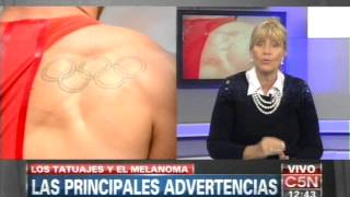 C5N  SALUD LOS TATUAJES Y EL PELIGRO DE LOS LUNARES [upl. by Keith121]