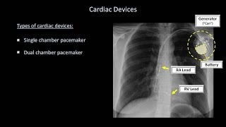 How to Interpret a Chest XRay Lesson 9  Atelectasis Lines Tubes Devices and Surgeries [upl. by Asselem]