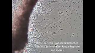 Streptomyces sp [upl. by Alasdair]