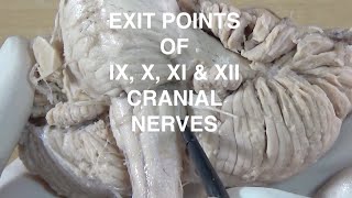 EXIT POINTS OF IX X XI amp XII CRANIAL NERVES [upl. by Annaira]