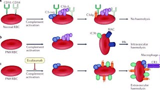 Paroxysmal nocturnal hemoglobinuria PNH [upl. by Maitilde514]