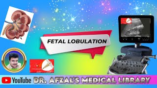 fetal lobulation of kidneys [upl. by Lleuqar363]