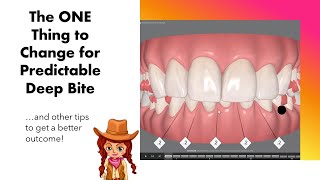 Invisalign ClinCheck  The 1 Thing to do for Deep Bite predictability [upl. by Grubman]