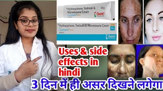 Cosmelite Cream Cosmelite Cream honest review Cosmelite cream benefits uses ampside effects in hindi [upl. by Arej]