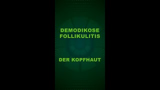 Demodikose Follikulitis der Kopfhaut [upl. by Wakerly812]