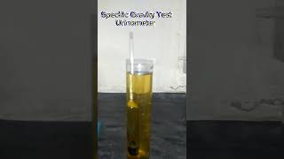 UrinometerSpecific GravityUrine TestSpGUrine specific gravitypracticle Urinometerdemonstration [upl. by Tito]