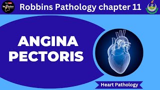 Angina PectorisRobbins Pathology 11Pathology lecturesHeart pathology pathology robbins heart [upl. by Evets801]